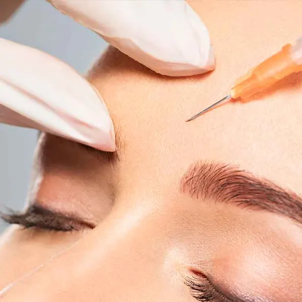 botox em SP
