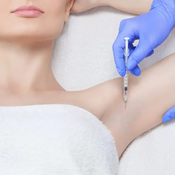 botox no tratamento da hiperidrose em SP