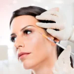 botox no rosto em SP
